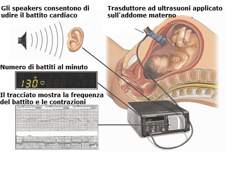 Diagnosticare-sofferenza-fetale