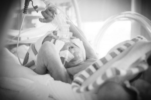 ventilazione-neonatale