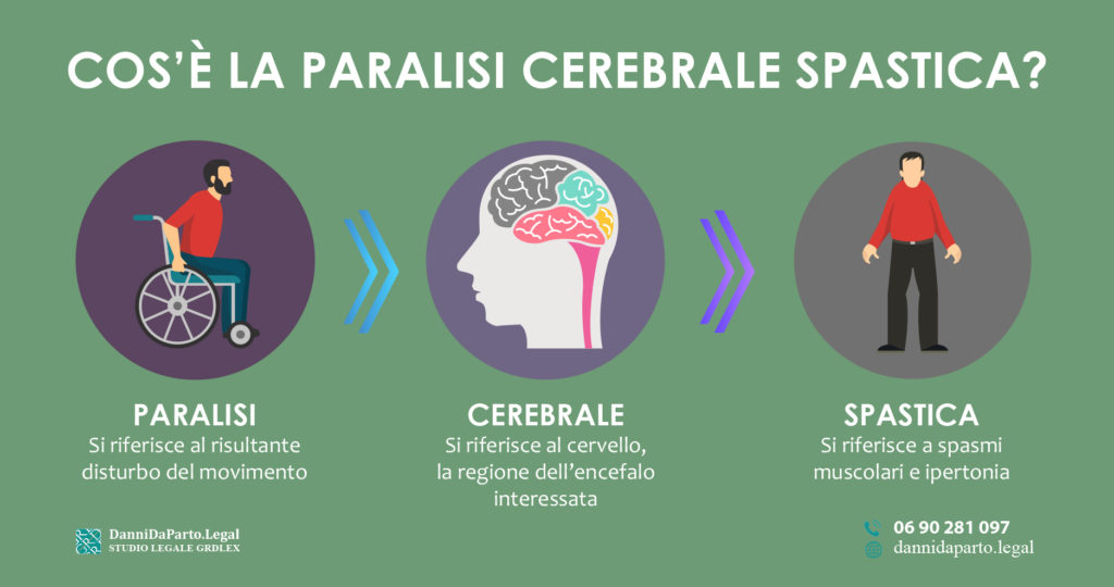 Paralisi-cerebrale-spastica