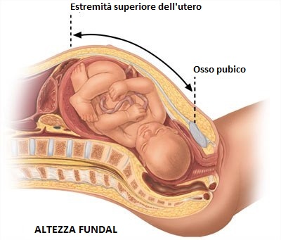 Altezza-Fundal