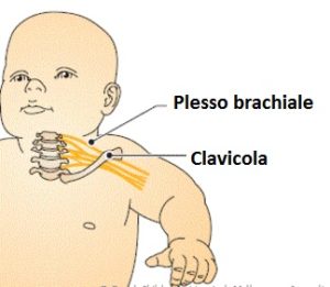Nervi-plesso-brachiale-bambino