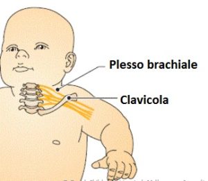 Nervi-plesso-brachiale-bambino