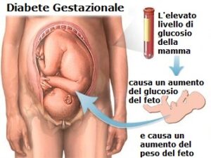 Diabete-Gestazionale