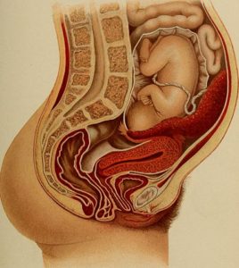 gravidanza-ectopica