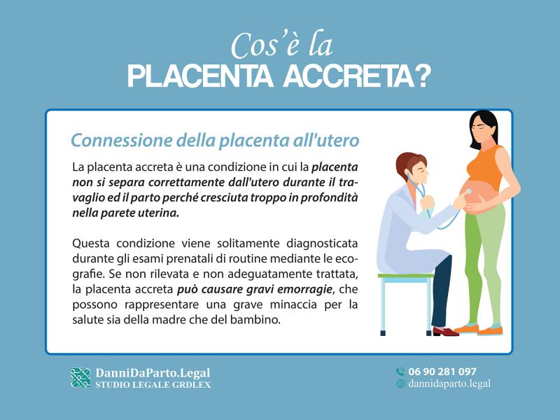 placenta-accreta