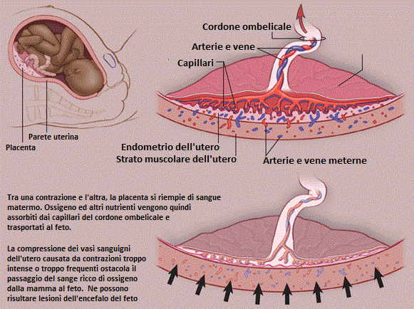 Iperstimolazione-utero